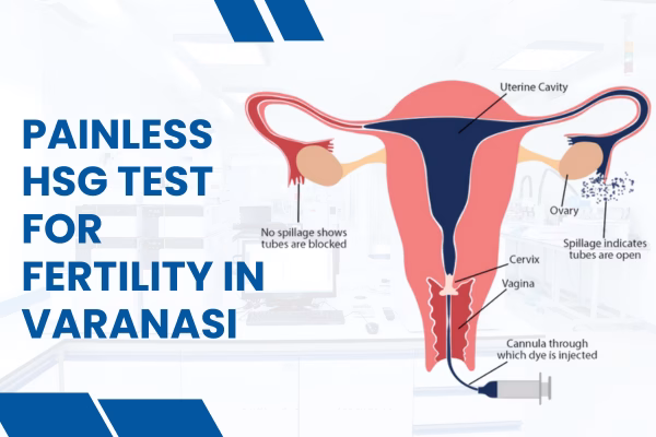 Painless HSG Test for Fertility in Varanasi
