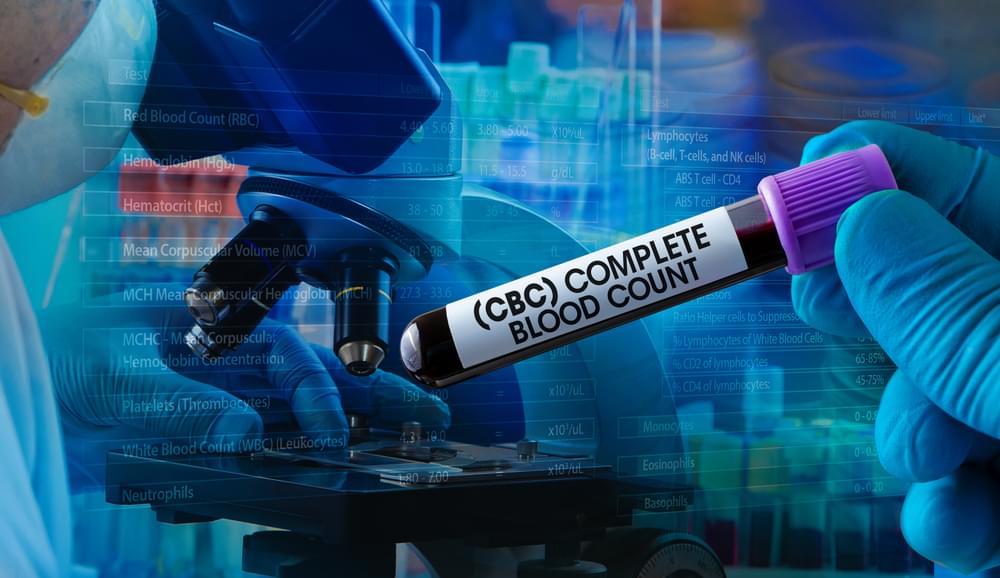 cbc-test-in-varanasi