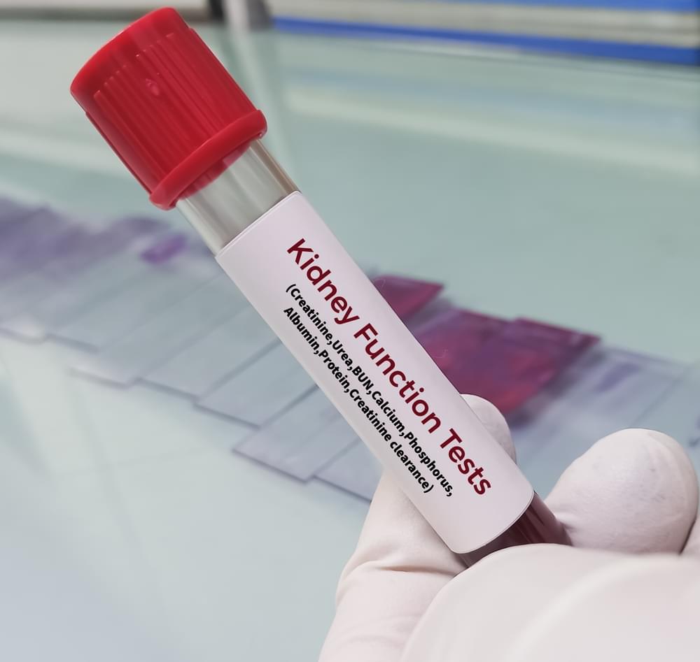 KFT test-in-varanasi