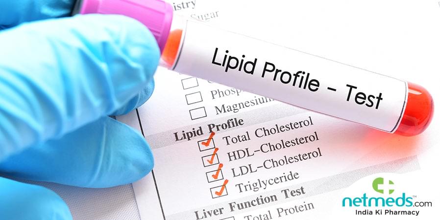 lipid-profile-test-in-varanasi